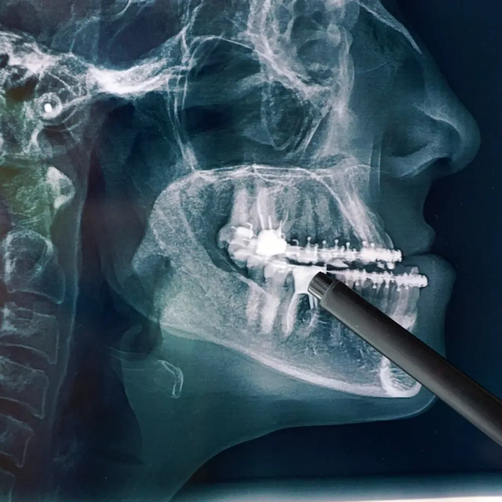 CIRUGÍA MAXILOFACIAL - Imagen